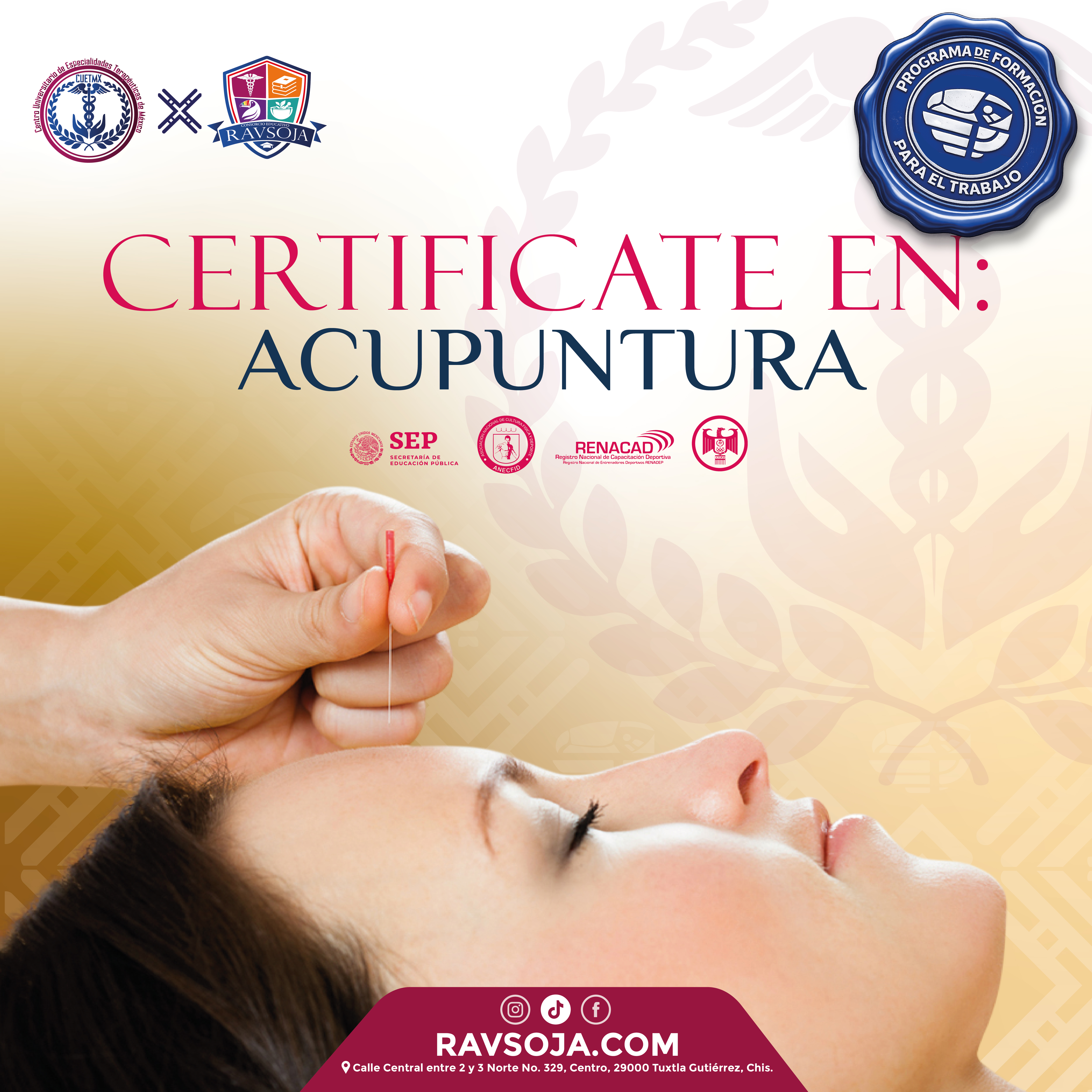 ACUPUNTURA